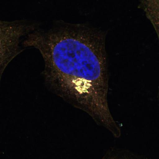  NCBI Organism:Homo sapiens; Cell Types:epithelial cell, ; Cell Components:Golgi-associated vesicle, COPI vesicle coat, nucleus, integral to membrane, Golgi cisterna membrane; Biological process:retrograde vesicle-mediated transport, Golgi to ER, protein O-linked glycosylation via serine, protein O-linked glycosylation via threonine, COPI coating of Golgi vesicle;