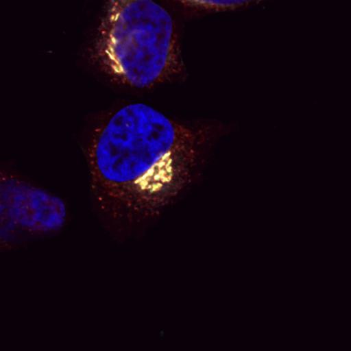  NCBI Organism:Homo sapiens; Cell Types:epithelial cell, ; Cell Components:Golgi-associated vesicle, COPI vesicle coat, nucleus, integral to membrane, Golgi cisterna membrane; Biological process:retrograde vesicle-mediated transport, Golgi to ER, protein O-linked glycosylation via serine, protein O-linked glycosylation via threonine, COPI coating of Golgi vesicle;