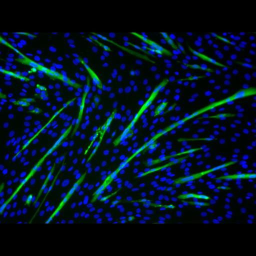  NCBI Organism:Mus musculus; Cell Types:myoblast Cell Components:nucleus, muscle myosin complex; Biological process:myoblast fusion