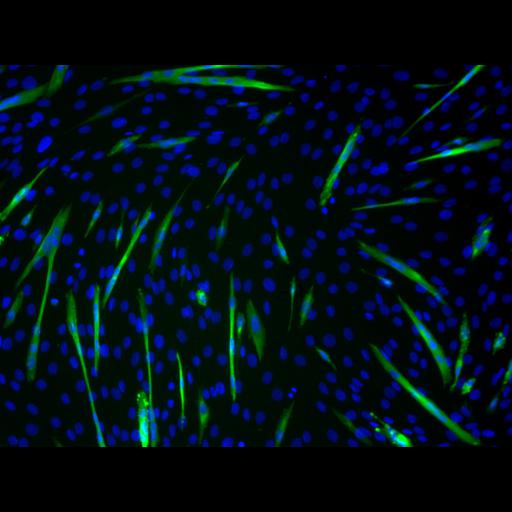  NCBI Organism:Mus musculus; Cell Types:myoblast Cell Components:nucleus, muscle myosin complex; Biological process:myoblast fusion