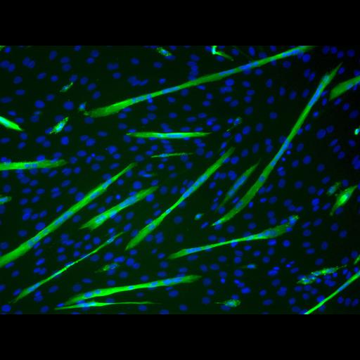  NCBI Organism:Mus musculus; Cell Types:myoblast Cell Components:nucleus, muscle myosin complex; Biological process:myoblast fusion