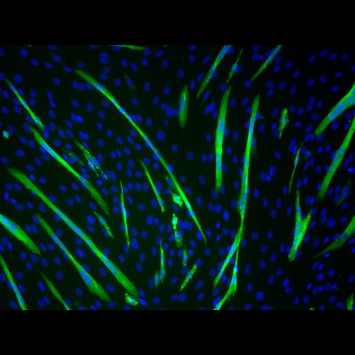  NCBI Organism:Mus musculus; Cell Types:myoblast Cell Components:nucleus, muscle myosin complex; Biological process:myoblast fusion