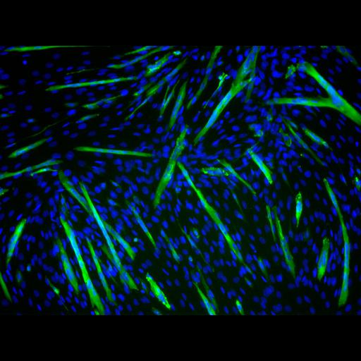  NCBI Organism:Mus musculus; Cell Types:myoblast Cell Components:nucleus, muscle myosin complex; Biological process:myoblast fusion