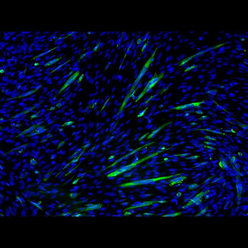  NCBI Organism:Mus musculus; Cell Types:myoblast Cell Components:nucleus, muscle myosin complex; Biological process:myoblast fusion