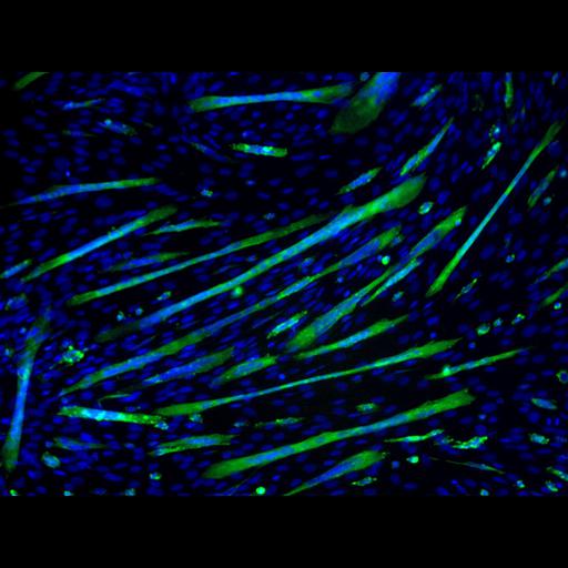  NCBI Organism:Mus musculus; Cell Types:myoblast Cell Components:nucleus, muscle myosin complex; Biological process:myoblast fusion