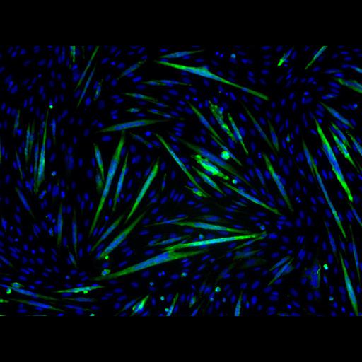  NCBI Organism:Mus musculus; Cell Types:myoblast Cell Components:nucleus, muscle myosin complex; Biological process:myoblast fusion