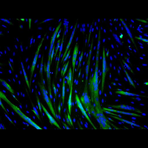  NCBI Organism:Mus musculus; Cell Types:myoblast Cell Components:nucleus, muscle myosin complex; Biological process:myoblast fusion