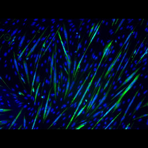  NCBI Organism:Mus musculus; Cell Types:myoblast Cell Components:nucleus, muscle myosin complex; Biological process:myoblast fusion