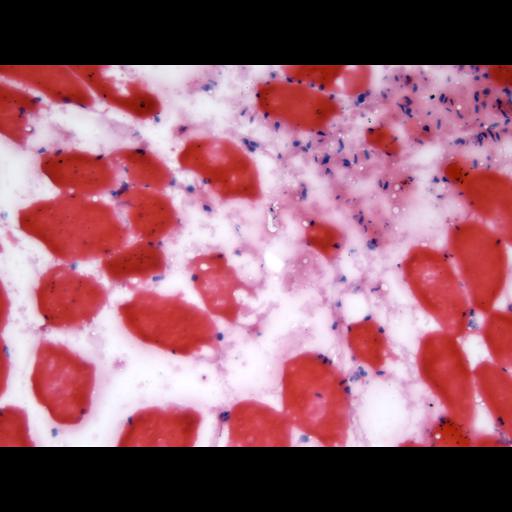  NCBI Organism:Mus musculus; Cell Types:skeletal muscle cell Cell Components:nucleus Biological process:myoblast fusion involved in skeletal muscle regeneration