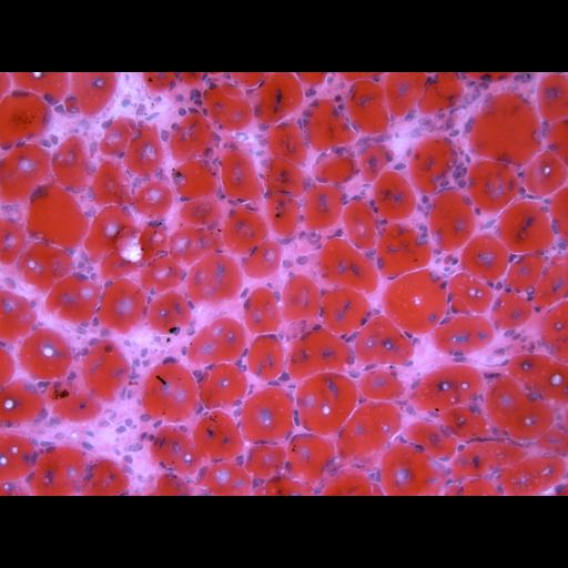  NCBI Organism:Mus musculus; Cell Types:skeletal muscle cell Cell Components:nucleus Biological process:myoblast fusion involved in skeletal muscle regeneration