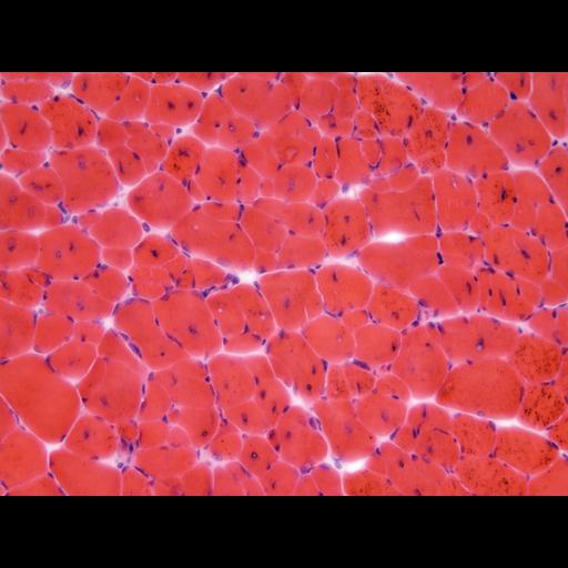  NCBI Organism:Mus musculus; Cell Types:skeletal muscle cell Cell Components:nucleus Biological process:myoblast fusion involved in skeletal muscle regeneration