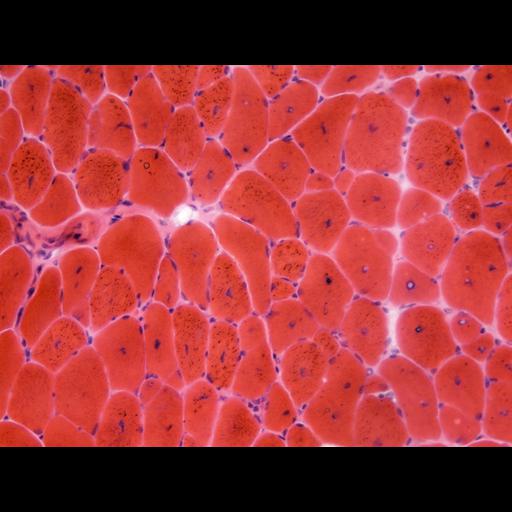  NCBI Organism:Mus musculus; Cell Types:skeletal muscle cell Cell Components:nucleus Biological process:myoblast fusion involved in skeletal muscle regeneration