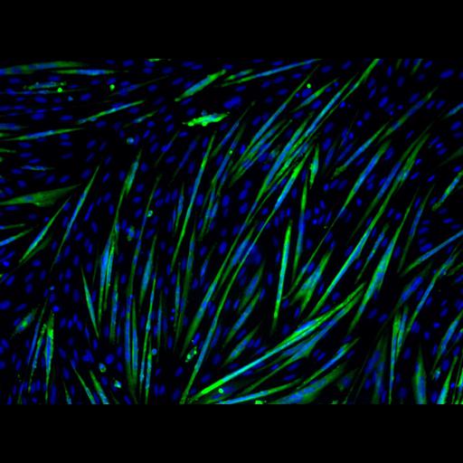  NCBI Organism:Mus musculus; Cell Types:myoblast Cell Components:nucleus, muscle myosin complex; Biological process:myoblast fusion