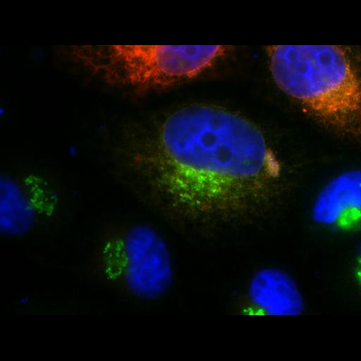  NCBI Organism:Homo sapiens; Cell Types:epithelial cell, ; Cell Components:Golgi apparatus, integral to membrane, Golgi membrane, endoplasmic reticulum, endoplasmic reticulum-Golgi intermediate compartment; Biological process:protein N-linked glycosylation via asparagine, carbohydrate metabolic process;