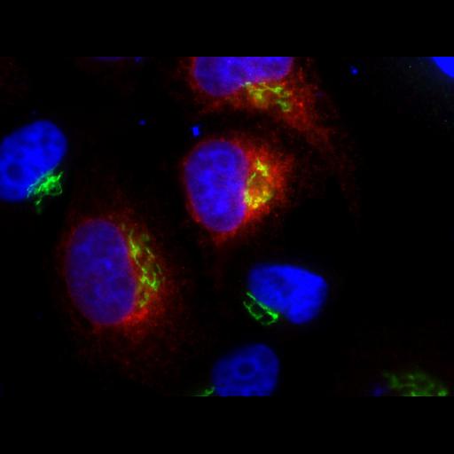  NCBI Organism:Homo sapiens; Cell Types:epithelial cell, ; Cell Components:Golgi apparatus, integral to membrane, Golgi membrane, endoplasmic reticulum, endoplasmic reticulum-Golgi intermediate compartment; Biological process:protein N-linked glycosylation via asparagine, carbohydrate metabolic process;