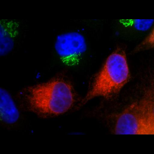  NCBI Organism:Homo sapiens; Cell Types:epithelial cell, ; Cell Components:Golgi apparatus, integral to membrane, Golgi membrane, endoplasmic reticulum, endoplasmic reticulum-Golgi intermediate compartment; Biological process:protein N-linked glycosylation via asparagine, carbohydrate metabolic process;