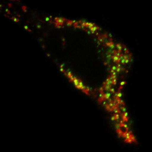  NCBI Organism:Homo sapiens; Cell Components:plasma membrane, lysosome; Biological process:receptor internalization, response to unfolded protein;