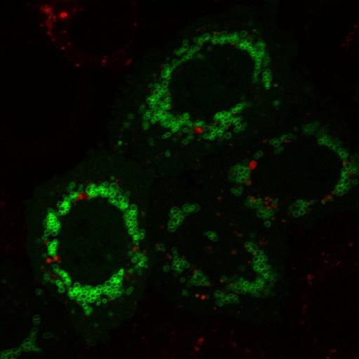  NCBI Organism:Homo sapiens; Cell Types:epithelial cell, ; Cell Components:mitochondrion, cytosol, nucleus; Biological process:mitochondrion degradation, protein K48-linked ubiquitination, protein K63-linked ubiquitination, protein ubiquitination involved in ubiquitin-dependent protein catabolic process;