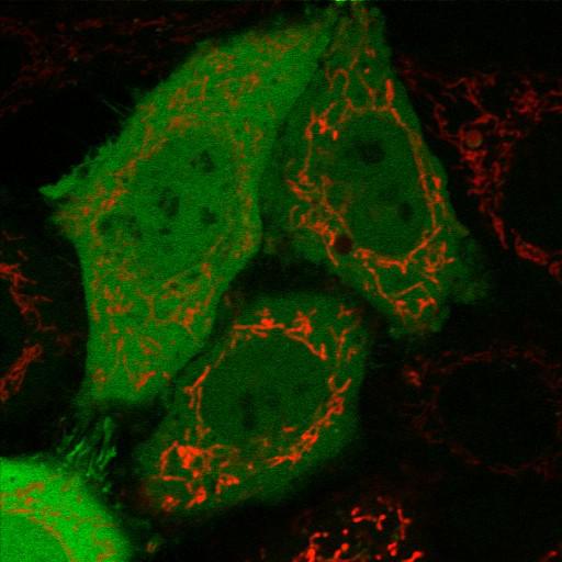  NCBI Organism:Homo sapiens; Cell Types:epithelial cell, ; Cell Components:mitochondrion, cytosol, nucleus; Biological process:mitochondrion degradation, protein K48-linked ubiquitination, protein K63-linked ubiquitination, protein ubiquitination involved in ubiquitin-dependent protein catabolic process;