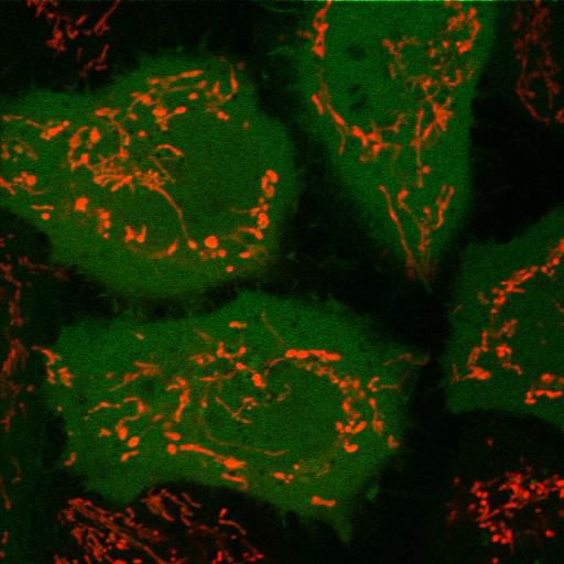  NCBI Organism:Homo sapiens; Cell Types:epithelial cell, ; Cell Components:mitochondrion, cytosol, nucleus, mitochondrial inner membrane; Biological process:mitochondrion degradation, protein K48-linked ubiquitination, protein K63-linked ubiquitination, protein ubiquitination involved in ubiquitin-dependent protein catabolic process;