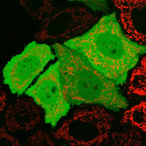  NCBI Organism:Homo sapiens; Cell Types:epithelial cell, ; Cell Components:mitochondrion, cytosol, nucleus; Biological process:mitochondrion degradation, protein K48-linked ubiquitination, protein K63-linked ubiquitination, protein ubiquitination involved in ubiquitin-dependent protein catabolic process;