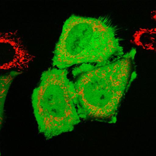  NCBI Organism:Homo sapiens; Cell Types:epithelial cell, ; Cell Components:mitochondrion, cytosol, nucleus; Biological process:mitochondrion degradation, protein K48-linked ubiquitination, protein K63-linked ubiquitination, protein ubiquitination involved in ubiquitin-dependent protein catabolic process;