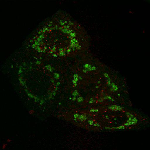  NCBI Organism:Homo sapiens; Cell Types:epithelial cell, ; Cell Components:mitochondrion, cytosol, nucleus; Biological process:mitochondrion degradation, protein K48-linked ubiquitination, protein K63-linked ubiquitination, protein ubiquitination involved in ubiquitin-dependent protein catabolic process;