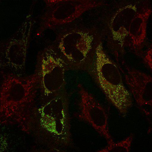  NCBI Organism:Homo sapiens; Cell Types:epithelial cell, ; Cell Components:mitochondrion, mitochondrial inner membrane, mitochondrial outer membrane; Biological process:protein phosphorylation, intracellular protein kinase cascade, response to stress;