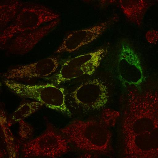  NCBI Organism:Homo sapiens; Cell Types:epithelial cell, ; Cell Components:mitochondrion, mitochondrial inner membrane, mitochondrial outer membrane; Biological process:protein phosphorylation, intracellular protein kinase cascade, response to stress;