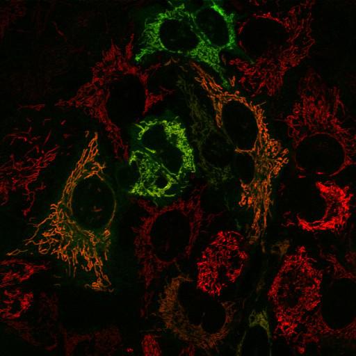  NCBI Organism:Homo sapiens; Cell Types:epithelial cell, ; Cell Components:mitochondrion, mitochondrial inner membrane, mitochondrial outer membrane; Biological process:protein phosphorylation, intracellular protein kinase cascade, response to stress;