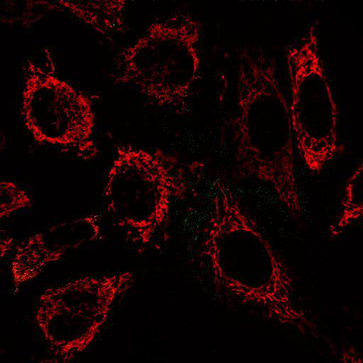  NCBI Organism:Homo sapiens; Cell Types:epithelial cell, ; Cell Components:mitochondrion, mitochondrial inner membrane, mitochondrial outer membrane; Biological process:protein phosphorylation, intracellular protein kinase cascade, response to stress;