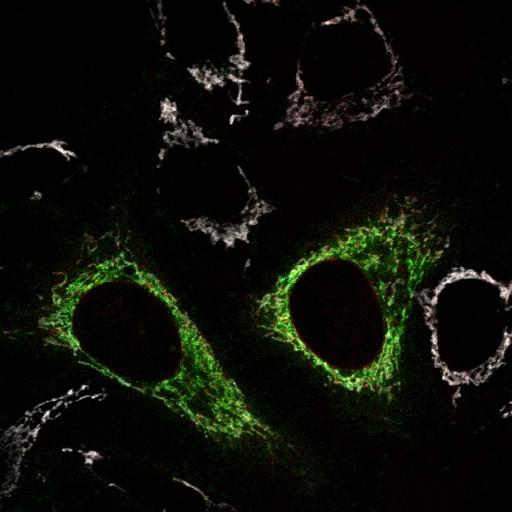  NCBI Organism:Homo sapiens; Cell Types:endothelial cell Cell Components:mitochondrion, mitochondrial outer membrane translocase complex, mitochondrial inner membrane, mitochondrial outer membrane; Biological process:protein targeting to mitochondrion, response to stress, protein phosphorylation, intracellular protein kinase cascade;