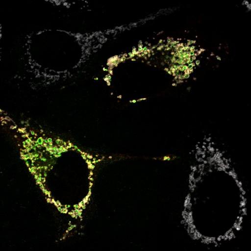  NCBI Organism:Homo sapiens; Cell Types:endothelial cell Cell Components:mitochondrion, mitochondrial outer membrane translocase complex, mitochondrial inner membrane, mitochondrial outer membrane; Biological process:protein targeting to mitochondrion, response to stress, protein phosphorylation, intracellular protein kinase cascade;