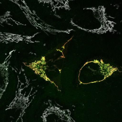  NCBI Organism:Homo sapiens; Cell Types:endothelial cell Cell Components:mitochondrion, mitochondrial outer membrane translocase complex, mitochondrial inner membrane, mitochondrial outer membrane; Biological process:protein targeting to mitochondrion, response to stress, protein phosphorylation, intracellular protein kinase cascade;