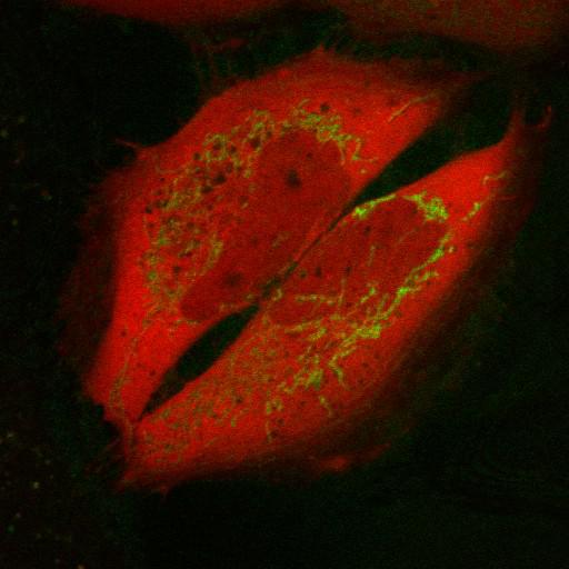  NCBI Organism:Homo sapiens; Cell Types:endothelial cell Cell Components:mitochondrion, cytosol, nucleus, mitochondrial inner membrane, mitochondrial outer membrane; Biological process:mitochondrion degradation, protein ubiquitination involved in ubiquitin-dependent protein catabolic process, response to stress, protein phosphorylation, intracellular protein kinase cascade, protein K48-linked ubiquitination, protein K63-linked ubiquitination;