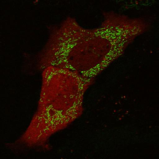  NCBI Organism:Mus musculus; Cell Types:fibroblast Cell Components:mitochondrion, cytosol, nucleus, mitochondrial inner membrane, mitochondrial outer membrane; Biological process:mitochondrion degradation, protein ubiquitination involved in ubiquitin-dependent protein catabolic process, response to stress, protein phosphorylation, intracellular protein kinase cascade, protein K48-linked ubiquitination, protein K63-linked ubiquitination;