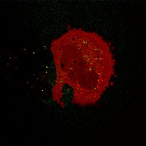  NCBI Organism:Mus musculus; Cell Types:fibroblast Cell Components:mitochondrion, cytosol, nucleus, mitochondrial inner membrane, mitochondrial outer membrane; Biological process:mitochondrion degradation, protein ubiquitination involved in ubiquitin-dependent protein catabolic process, response to stress, protein phosphorylation, intracellular protein kinase cascade, protein K48-linked ubiquitination, protein K63-linked ubiquitination;