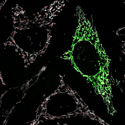  NCBI Organism:Homo sapiens; Cell Types:endothelial cell Cell Components:mitochondrion, mitochondrial outer membrane translocase complex, mitochondrial intermembrane space; Biological process:respiratory electron transport chain, protein targeting to mitochondrion;