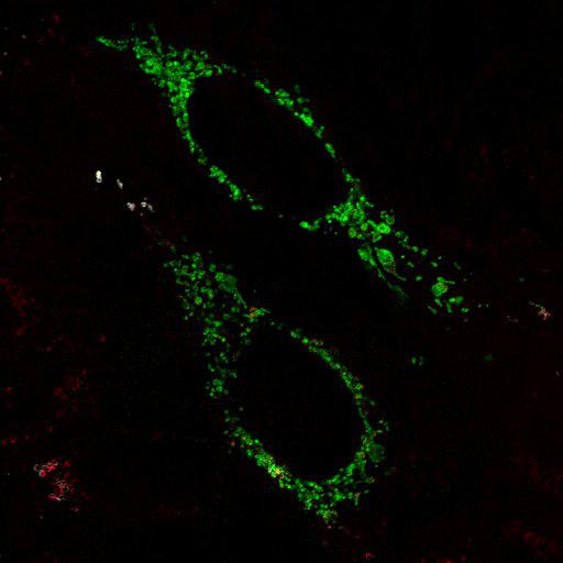  NCBI Organism:Homo sapiens; Cell Types:endothelial cell Cell Components:mitochondrion, mitochondrial outer membrane translocase complex, mitochondrial intermembrane space; Biological process:respiratory electron transport chain, protein targeting to mitochondrion;