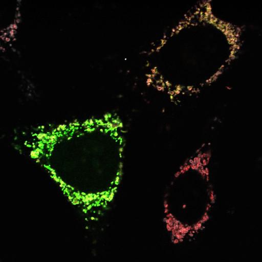  NCBI Organism:Homo sapiens; Cell Types:endothelial cell Cell Components:mitochondrion, mitochondrial outer membrane translocase complex, mitochondrial intermembrane space; Biological process:respiratory electron transport chain, protein targeting to mitochondrion;