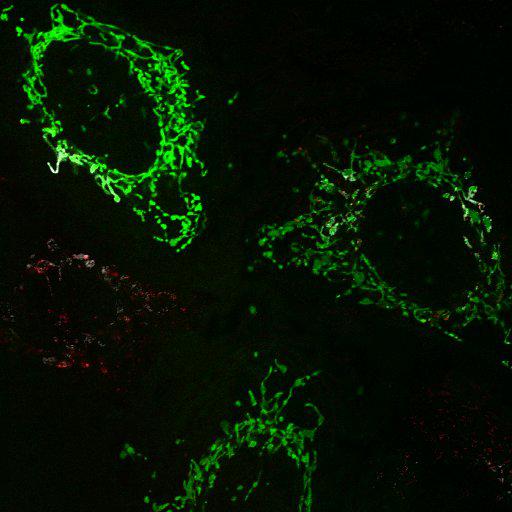  NCBI Organism:Homo sapiens; Cell Types:endothelial cell Cell Components:mitochondrion, mitochondrial outer membrane translocase complex, mitochondrial intermembrane space; Biological process:respiratory electron transport chain, protein targeting to mitochondrion;