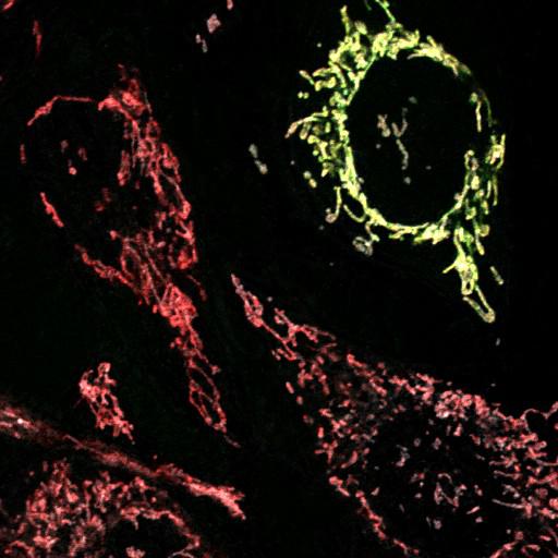  NCBI Organism:Homo sapiens; Cell Types:endothelial cell Cell Components:mitochondrion, mitochondrial outer membrane translocase complex, mitochondrial intermembrane space; Biological process:respiratory electron transport chain, protein targeting to mitochondrion;