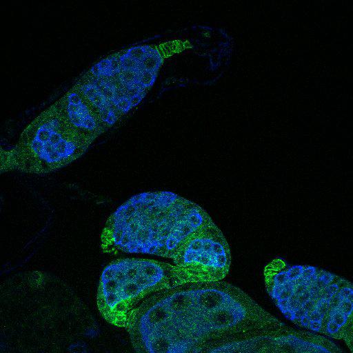  NCBI Organism:Drosophila melanogaster; Cell Types:germ line cell, follicle cell, germ line stem cell, follicle stem cell; Cell Components:P granule Biological process:smoothened signaling pathway, cell adhesion, germ-line cyst formation, germarium-derived egg chamber formation, positive regulation of translation;