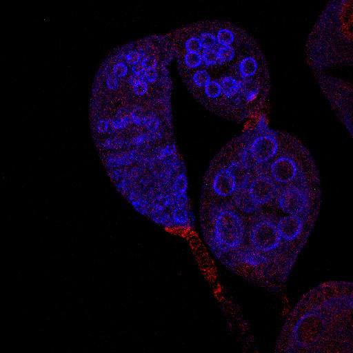  NCBI Organism:Drosophila melanogaster; Cell Types:germ line cell, follicle cell, germ line stem cell, follicle stem cell; Cell Components:P granule Biological process:smoothened signaling pathway, cell adhesion, germ-line cyst formation, germarium-derived egg chamber formation, positive regulation of translation;