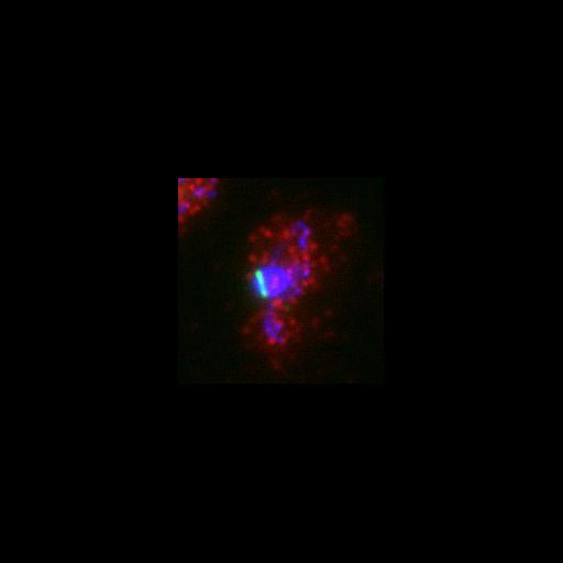  NCBI Organism:Saccharomyces cerevisiae; Cell Components:spindle pole body, nucleus, microtubule, spindle pole body, tubulin complex; Biological process:cytokinesis, protein phosphorylation, regulation of exit from mitosis, mitotic sister chromatid segregation, microtubule-based process;