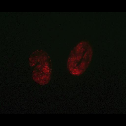  NCBI Organism:Caenorhabditis elegans; Biological process:autophagy