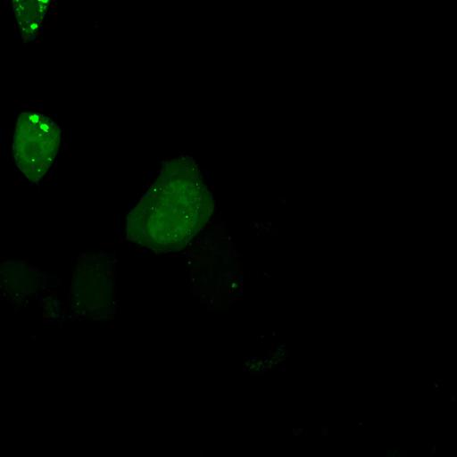  NCBI Organism:Homo sapiens; Cell Types:permanent cell line cell Cell Components:autophagic vacuole Biological process:autophagy