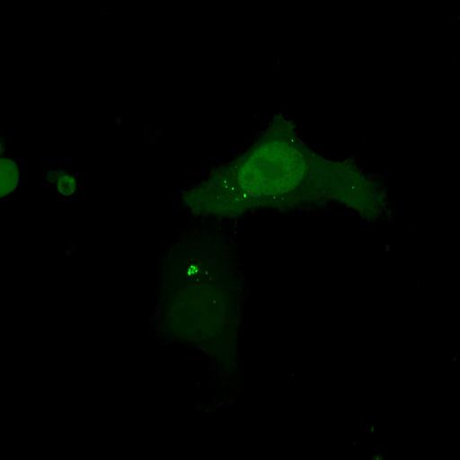  NCBI Organism:Homo sapiens; Cell Types:permanent cell line cell Cell Components:autophagic vacuole Biological process:autophagy