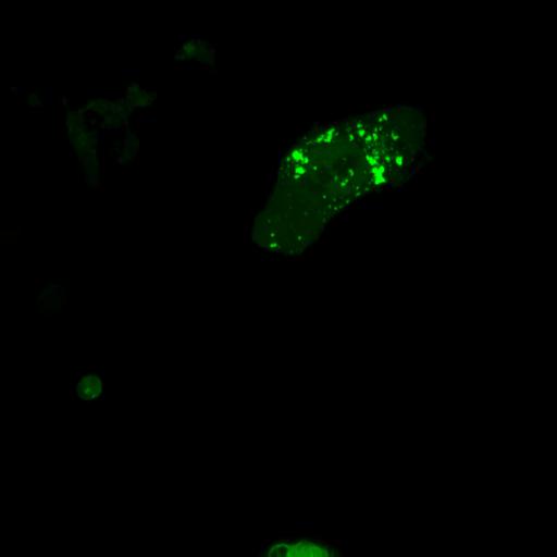  NCBI Organism:Homo sapiens; Cell Types:permanent cell line cell Cell Components:autophagic vacuole Biological process:autophagy