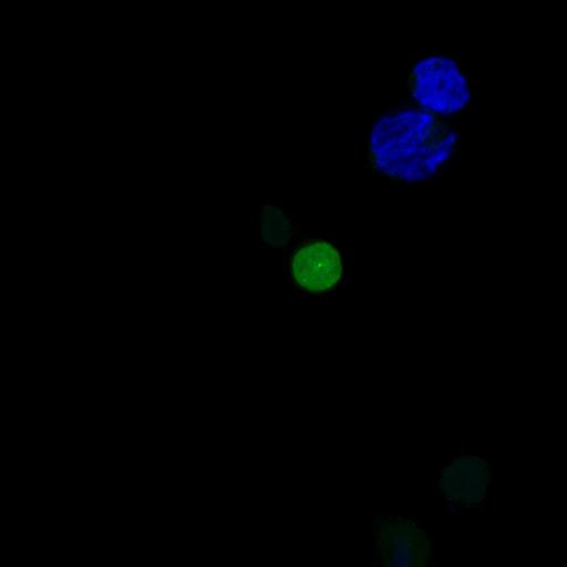  NCBI Organism:Homo sapiens; Cell Types:permanent cell line cell Cell Components:autophagic vacuole Biological process:autophagy